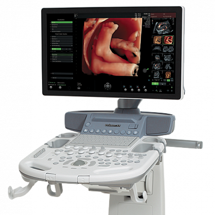 Voluson S8